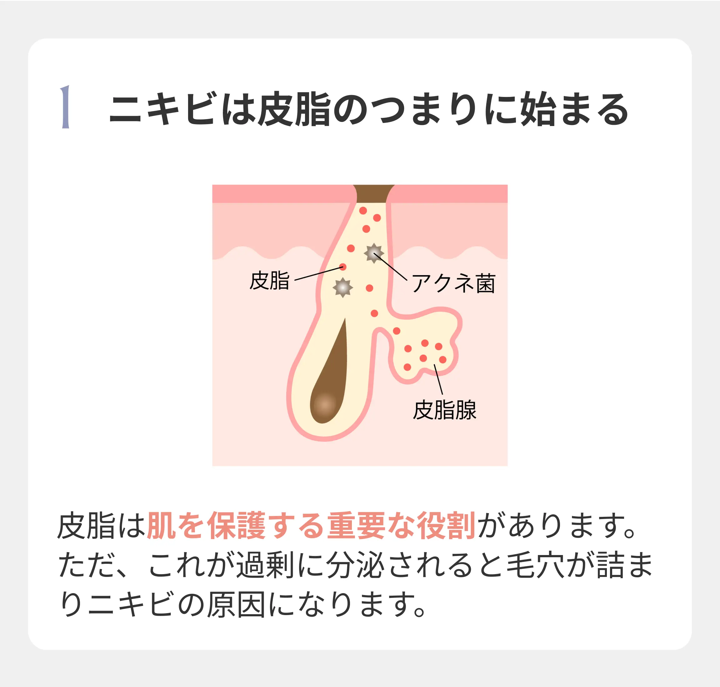 ニキビは皮脂のつまりに始まる 